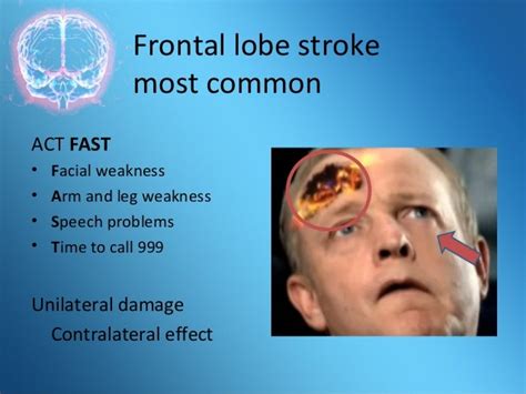 Effects Of Damage To Frontal Lobe