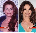 Roma Downey Plastic Surgery Before And After Photos - CelebLens.Com