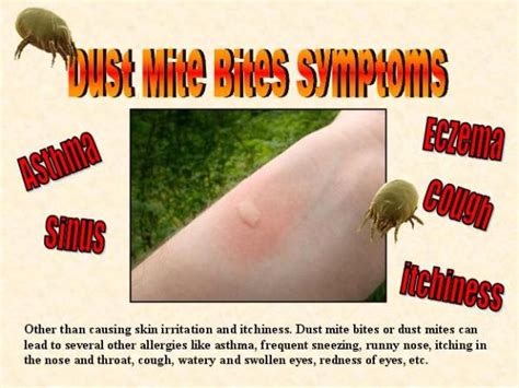 Oak mite bites look similar to chigger bites. Bayer bug spray for bed bugs, fruit flies spray walmart ...