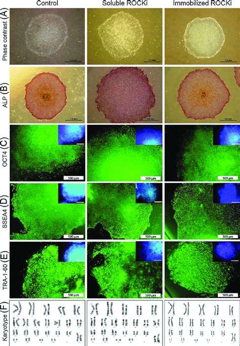 Characterization Of Human Embryonic Stem Cell Hesc Royan H5 Under