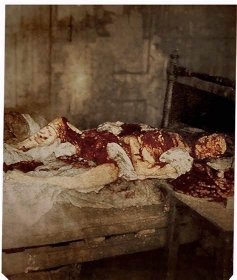 Jack The Ripper Autopsy Photos My Xxx Hot Girl