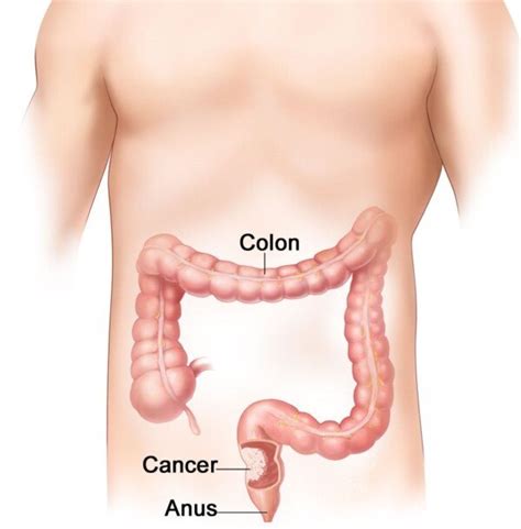 As a lifelong sufferer of ibs i do recognise what you're going through. Poops: Green, Skinny, Pebbly, Colon Cancer » Scary Symptoms