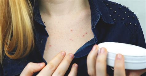 How To Treat Chest Acne According To Dermatologists Popsugar Beauty Uk