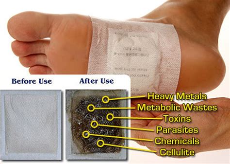 How To Make Homemade Detox Foot Pads To Remove Toxins From Your Body