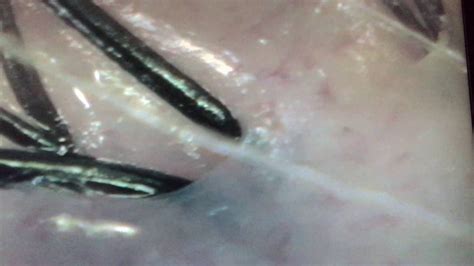 【頭皮毛穴】Scalp pores頭皮ケア マイクロカメラで頭皮 ...