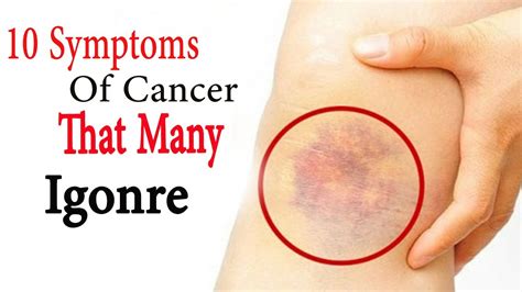 10 Cancer Symptoms Most People Ignore River Oaks Beauty Bar