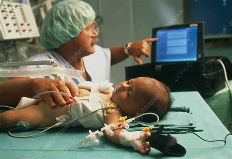 Baby Girl Being Monitored After Heart Surgery Stock Image M8200337