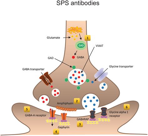 Gad Antibody Spectrum Disorders Progress In Clinical Phenotypes