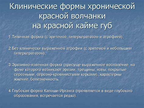 Диета при системная красная волчанка Красная Волчанка Диета — Похудение Диета Правильное Питание Красная Волчанка Диета — Похудение Диета Правильное Питание Диета при системная красная волчанка