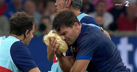 RUGBY XV De France Blessure Antoine Dupont Vers Une Longue Absence