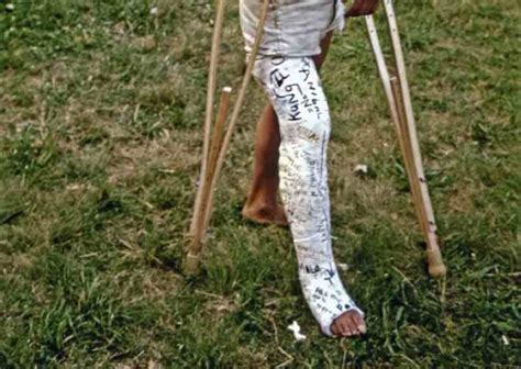 Average Broken Leg Settlement After Car Accident Geerhart Law