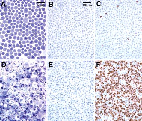 Improved Detection Of Apoptotic Cells In Archival Paraffin Sections