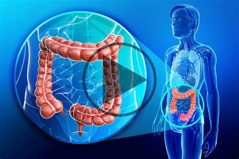 Management Of Braf Mutant Metastatic Colorectal Cancer Oncology Central