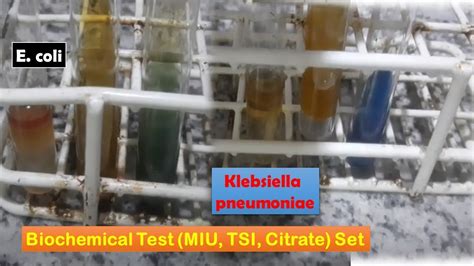 Escherichia Coli And Klebsiella Pneumoniae Biochemical Tests