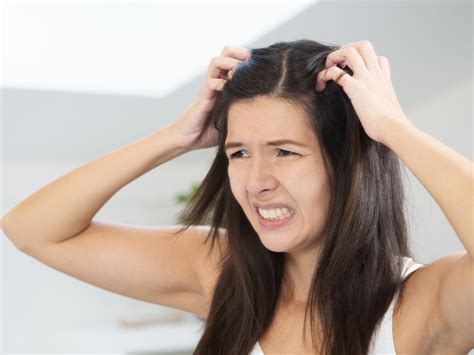 Does Stress Cause Dandruff Styles At Life