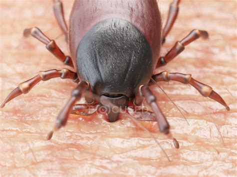 Illustration Of Small Tick Biting Human Skin — Artwork Pest Stock