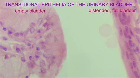 Transitional Epithelia Of The Urinary Bladder Youtube
