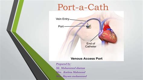 Port A Cath Ppt