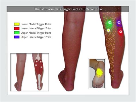 Leptospirosis, weil disease, infection due to leptospira, spirochaetal jaundice, seven day fever, cane cutters fever, harvest fever, japanese autumnal fever, queensland fever, rice field workers disease. Pin on Reflexology