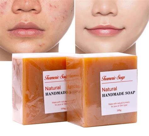 Pcs Natural Turmeric Dark Spot Anti Acne Facial Soap Etsy