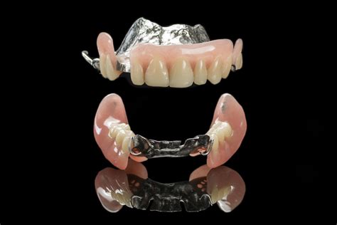 Edentulism Finding The Perfect Fit With Partial Dentures