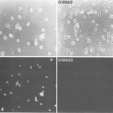 Yeast Cells Of H Capsulatum Virulent Strain G186ar And Avirulent