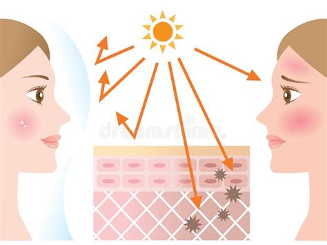 Infographic Skin Illustration Of Sunscreen Protect Skin Against Uv Rays
