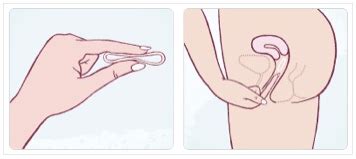 The vaginal ring is inserted into the vagina, where it stays for three weeks. Sex Ed for Beginners (Vaginal Ring (NuvaRing))