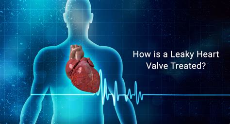 How Is A Leaky Heart Valve Treated Eternal Hospital