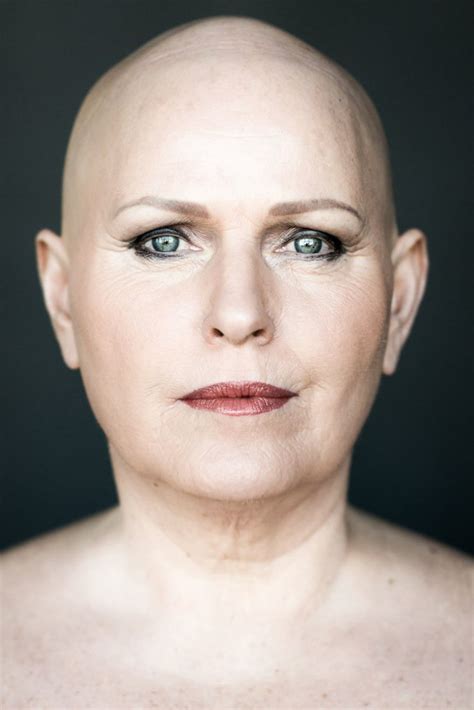 Photographer Sigga Ella Captures The Beauty Of Bald Women
