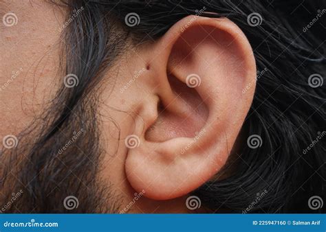 Small Hole In Front Of The Upper Side Of The Ear Which Is Known As