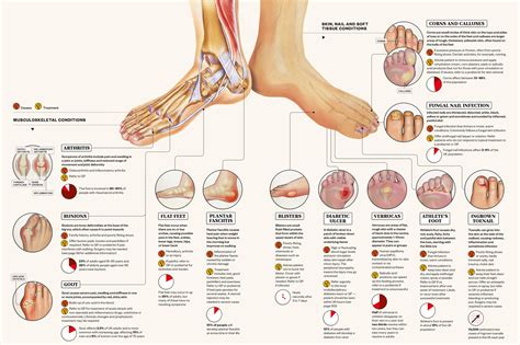 Feet Pain Symptoms