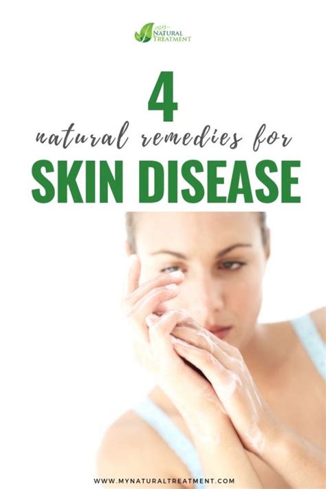 4 Natural Remedies For Skin Disease Mild And Severe Skin Disease