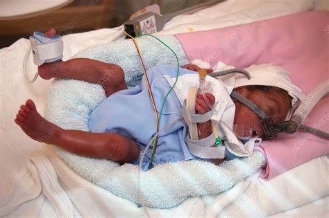 Premature Baby Boy In An Incubator In The Neonatal Unit Stock Image