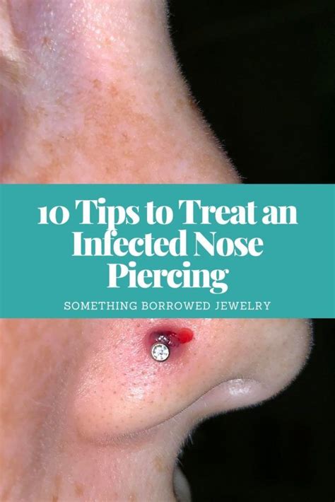 10 Tips To Treat An Infected Nose Piercing Nose Piercing Infection Nose Piercing Tips Nose