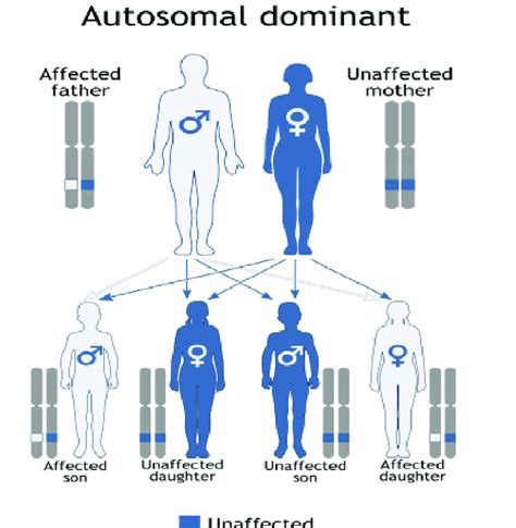 Schematic View Of The Dominant Autosomal Inheritance Pattern That Adds