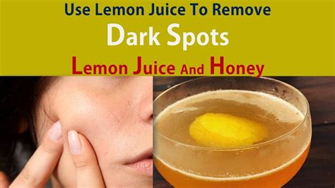 Use Lemon Juice To Remove Dark Spots Get Rid Dark Spots With Lemon