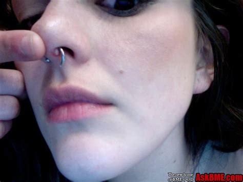 Infected Septum Piercing