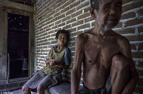 Indonesian Villages Mentally Ill Patients Are Pictured Shackled Or