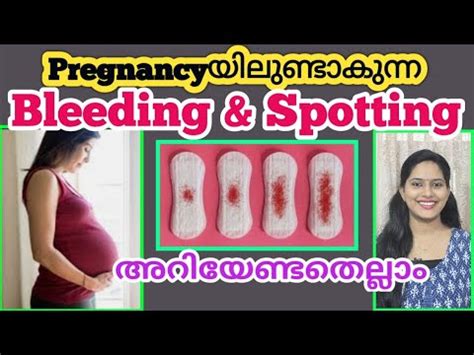 Vaginal Bleeding Spotting During Early Pregnancy Malayalam YouTube