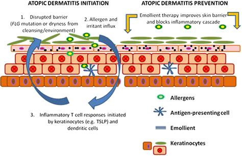 Emollient Enhancement Of The Skin Barrier From Birth Offers Effective