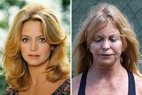Goldie Hawn Then And Now Ridiculously Extraordinary Then And Now Photos Celebrities