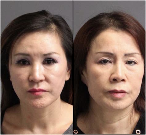 silver spring woman charged with prostitution at massage parlor silver spring md patch