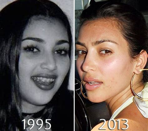 Kim Kardashian Nosejob Before And After Kim Kardashian Before Celebs