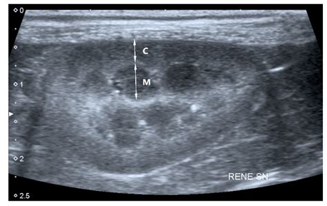 What Can Ultrasound Detect In Dogs