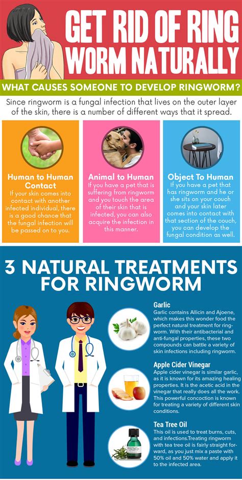Natural Ringworm Remedies To Keep In Your Home Naturelieved
