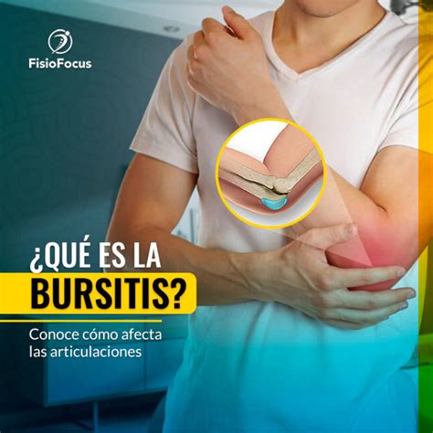Bursitis ¿cuáles Son Las Causas Y Síntomas ¿cómo Prevenir Fisiofocus