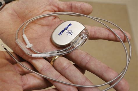 In the uk, pacemaker implantation is one of the most common types of heart surgery carried out, with many thousands of pacemakers fitted each year. Top 3 Cardiac Pacemaker Types and Information on It
