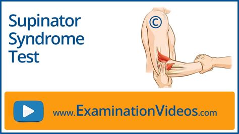 Supinator Syndrome Test Youtube