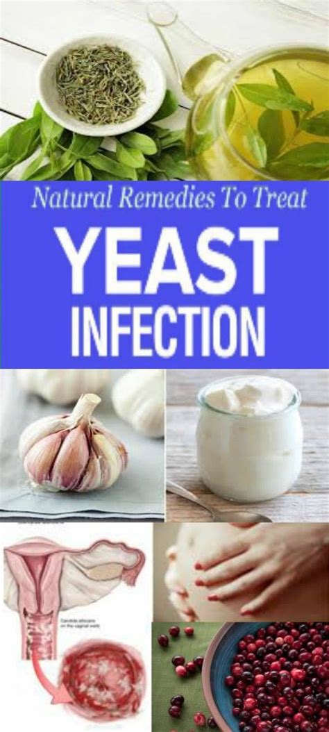 natural remedies to treat yeast infection with images treat yeast infection yeast infection